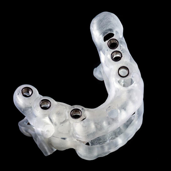 Diseño Digital de Sonrisa y Simulación de Tratamientos